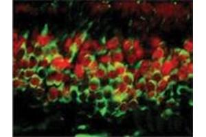 Image no. 1 for anti-DNA (Cytosine-5-)-Methyltransferase 3 alpha (DNMT3A) (AA 705-908), (C-Term) antibody (ABIN207958)