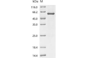 Eukaryotic Translation Elongation Factor 1 alpha 1 (EEF1A1) (AA 1-462), (full length) protein (His tag)