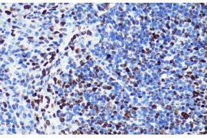 Immunohistochemistry of paraffin-embedded Mouse spleen using Acetyl-Histone H2B-K5 Polyclonal Antibody at dilution of 1:100 (40x lens).
