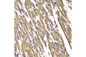 Immunohistochemistry of paraffin-embedded rat heart using SDHA antibody.