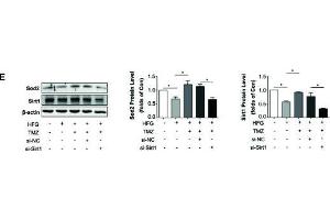 Trimetazidine (TMZ) reduced HFG-induced ROS generation and EMT depending on upregulation of Sirt1. (SIRT1 anticorps  (AA 448-747))