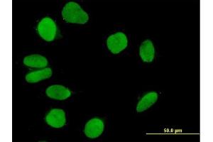 Immunofluorescence of purified MaxPab antibody to IQWD1 on HeLa cell.