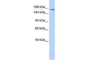 WB Suggested Anti-EPRS Antibody Titration:  0. (EPRS anticorps  (Middle Region))