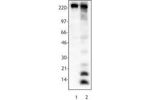 Image no. 1 for anti-Acetylated Lysine antibody (ABIN300042) (Acetylated Lysine anticorps)