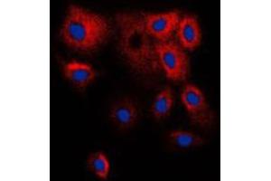 Immunofluorescent analysis of Cytochrome P450 2B6 staining in HepG2 cells. (CYP2B6 anticorps  (Center))