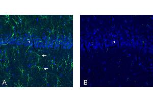 anti-Solute Carrier Family 19, Member 3 (Slc19a3) (AA 460-475), (C-Term), (Intracellular) antibody