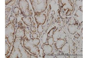 Image no. 1 for anti-Suppressor of Cytokine Signaling 5 (SOCS5) (AA 1-110) antibody (ABIN599092) (SOCS5 anticorps  (AA 1-110))