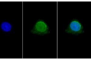Detection of HDAC6 in Human Hela cell using Polyclonal Antibody to Histone Deacetylase 6 (HDAC6)