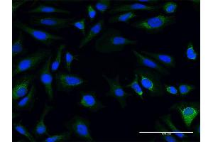 Immunofluorescence of purified MaxPab antibody to AK3L1 on HeLa cell.