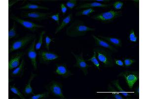 Immunofluorescence of purified MaxPab antibody to AK3L1 on HeLa cell. (AK4 anticorps  (AA 1-223))