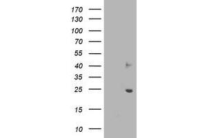 Western Blotting (WB) image for anti-Suppressor of Cytokine Signaling 3 (SOCS3) antibody (ABIN1501058) (SOCS3 anticorps)