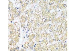 Immunohistochemistry of paraffin-embedded Human liver using ATP5I Polyclonal Antibody at dilution of 1:100 (40x lens). (ATP5I anticorps)