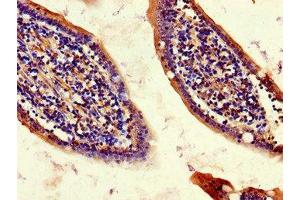 Immunohistochemistry of paraffin-embedded human small intestine tissue using ABIN7147222 at dilution of 1:100