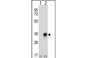 Western blot analysis of CBR3 (arrow) using rabbit polyclonal CBR3 Antibody (C-term) (ABIN656808 and ABIN2846022). (CBR3 anticorps  (C-Term))