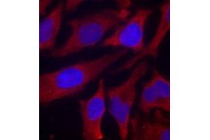 Immunofluorescence staining of methanol-fixed Hela cells using Phospho-SYN1-S9 antibody. (SYN1 anticorps  (pSer9))