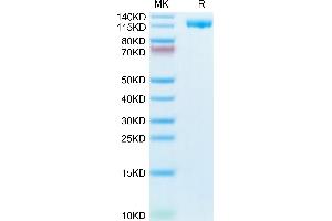 Human CD21 on Tris-Bis PAGE under reduced condition.