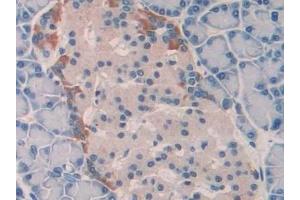 Detection of IL18 in Rat Pancreas Tissue using Polyclonal Antibody to Interleukin 18 (IL18)