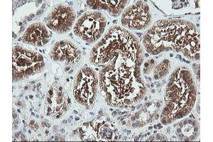 Immunohistochemistry (IHC) image for anti-Formiminotransferase Cyclodeaminase (FTCD) antibody (ABIN1496380)