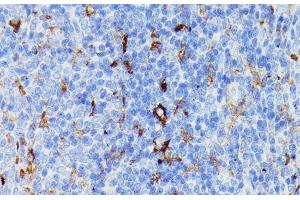 Immunohistochemistry of paraffin-embedded Rat spleen using MMP25 Polyclonal Antibody at dilution of 1:100 (40x lens). (MMP25 anticorps)
