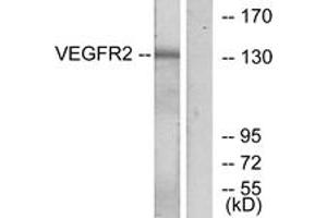 Western blot analysis of extracts from K562 cells, treated with LPS 100ng/ml 30', using VEGFR2 (Ab-1175) Antibody. (VEGFR2/CD309 anticorps  (AA 1141-1190))