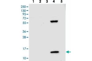 Western blot analysis of Lane 1: RT-4, Lane 2: U-251 MG, Lane 3: Human Plasma, Lane 4: Liver, Lane 5: Tonsil with PPP4R4 polyclonal antibody  at 1:250-1:500 dilution. (PPP4R4 anticorps)
