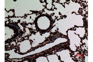 Immunohistochemistry (IHC) analysis of paraffin-embedded Rat Lung, antibody was diluted at 1:100.