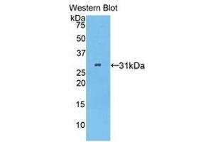 Western Blotting (WB) image for anti-Pitrilysin Metallopeptidase 1 (PITRM1) (AA 544-806) antibody (ABIN1859866)