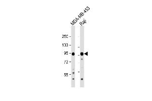 All lanes : Anti-AXIN1 Antibody (C-term) at 1:1000 dilution Lane 1: MDA-MB-453 whole cell lysate Lane 2: Raji whole cell lysate Lysates/proteins at 20 μg per lane. (Axin anticorps  (C-Term))