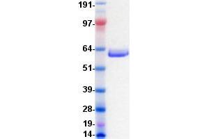 Validation with Western Blot