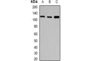 Western blot analysis of HIP1 expression in A549 (A), SW480 (B), mouse brain (C) whole cell lysates. (HIP1 anticorps)
