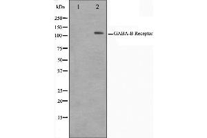 Western blot analysis on HeLa cell lysate using GABBR1 Antibody,The lane on the left is treated with the antigen-specific peptide. (GABBR1 anticorps  (C-Term))