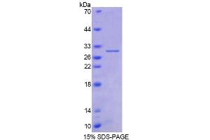 SDS-PAGE analysis of Human AGA Protein. (AGA Protéine)