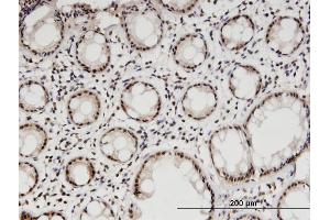 Immunoperoxidase of monoclonal antibody to DGCR8 on formalin-fixed paraffin-embedded human colon. (DGCR8 anticorps  (AA 675-771))