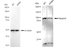 Western blotting analysis using Nesprin3 antibody (ABIN7798074).