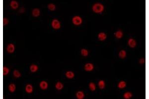 ABIN6266587 staining HepG2 by IF/ICC.