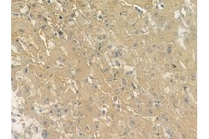 ABIN6262980 and ABIN6272946 at 1/100 staining human normal liver tissue by IHC-P. (PPFIA1 anticorps  (C-Term))