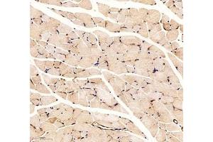 Immunohistochemistry of paraffin embedded mouse skeletal muscle using Palladin (ABIN7074976) at dilution of 1: 1000 (250x lens)