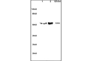 Formalin-fixed and paraffin embedded mouse embryo labeled with Anti GLUT8 Polyclonal Antibody, Unconjugated (ABIN705746) at 1:200 followed by conjugation to the secondary antibody and DAB staining