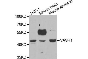 Western Blotting (WB) image for anti-Vasohibin 1 (VASH1) antibody (ABIN1877134) (VASH1 anticorps)
