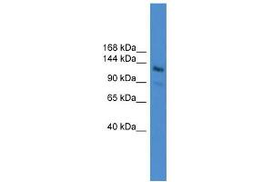 WB Suggested Anti-LARP1  Antibody Titration: 0. (LARP1 anticorps  (N-Term))