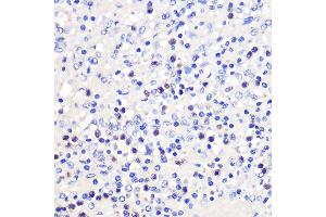 Immunohistochemistry of paraffin-embedded Human spleen using 4-1BB/CD137 Rabbit pAb (ABIN7271073) at dilution of 1:100 (40x lens).