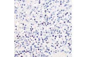 Immunohistochemistry of paraffin-embedded Human spleen using 4-1BB/CD137 Rabbit pAb (ABIN7271073) at dilution of 1:100 (40x lens). (CD137 anticorps  (AA 150-250))
