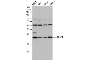 WB Image DUSP3 antibody detects DUSP3 protein by western blot analysis.