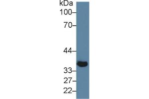Rabbit Capture antibody from the kit in WB with Positive Control: Mouse skeletal muscle lysate.