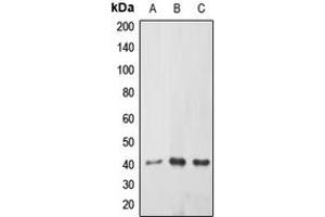 Western blot analysis of ABHD9 expression in HEK239T (A), mouse kidney (B), rat kidney (C) whole cell lysates. (ABHD9 anticorps  (Center))