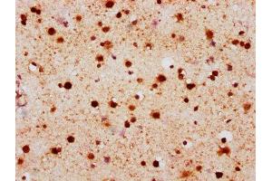 IHC image of ABIN7127309 diluted at 1:100 and staining in paraffin-embedded human brain tissue performed on a Leica BondTM system. (Recombinant H2AFX anticorps  (pSer139))