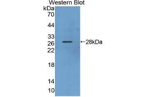 Detection of Recombinant KPNa3, Human using Polyclonal Antibody to Karyopherin Alpha 3 (KPNa3) (KPNA3 anticorps  (AA 3-220))