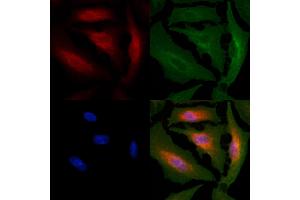 ABIN6261736 and ABIN6266540 staining  cells by IF/ICC. (FGFR3 anticorps  (C-Term))