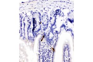 IHC analysis of Peptide YY using anti-Peptide YY antibody (ABIN4886709).