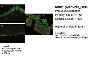 Image no. 2 for anti-Retinoblastoma Binding Protein 9 (RBBP9) (N-Term) antibody (ABIN2775962)